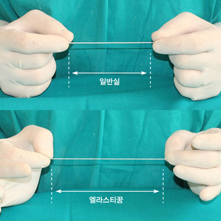 엘라스티꿈