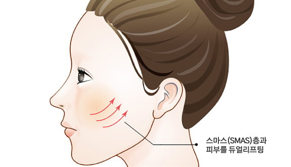 엘라스티꿈