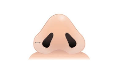 적당한 콧볼두께