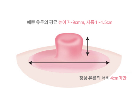 함몰유두교정