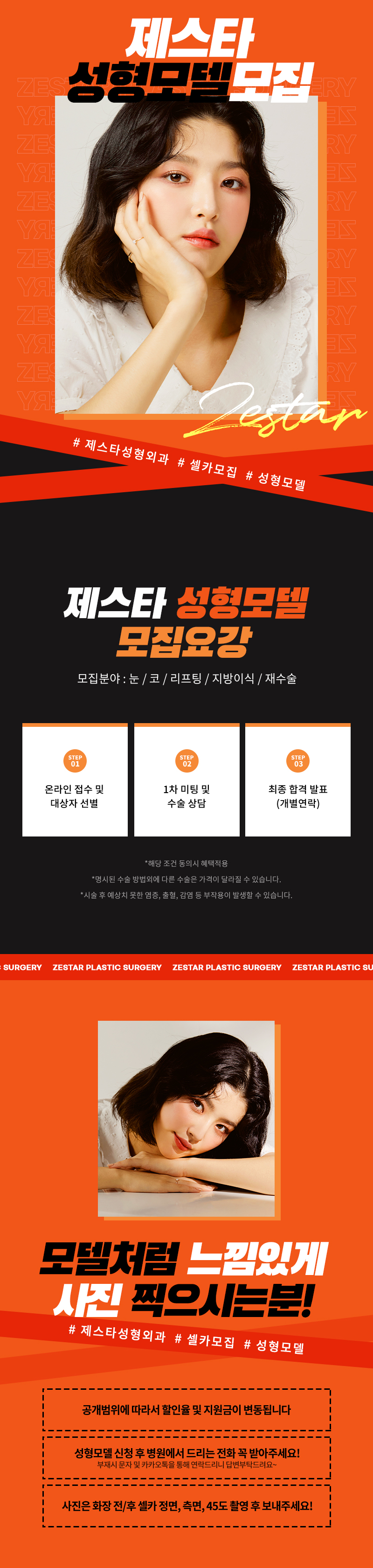 성형모델 지원