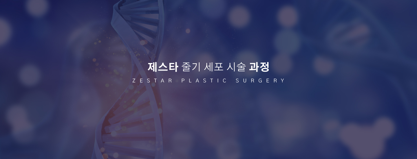 줄기세포시술과정
