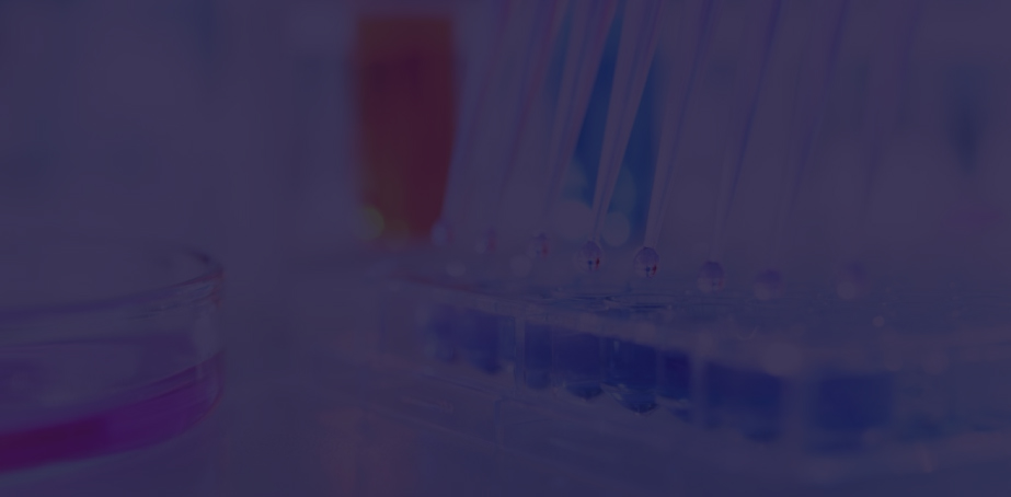 스마트x