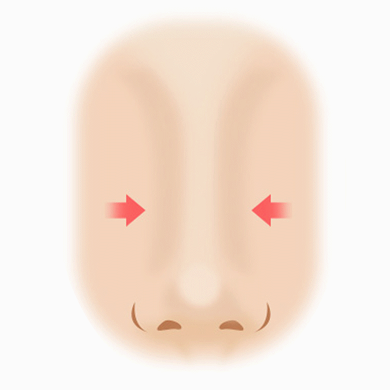 코재수술 수술방법