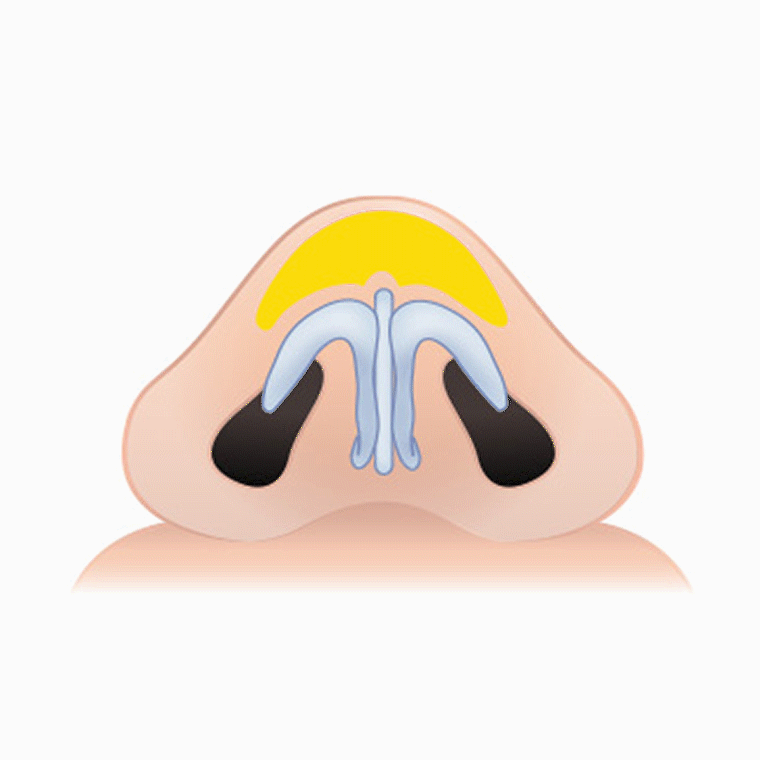 복코