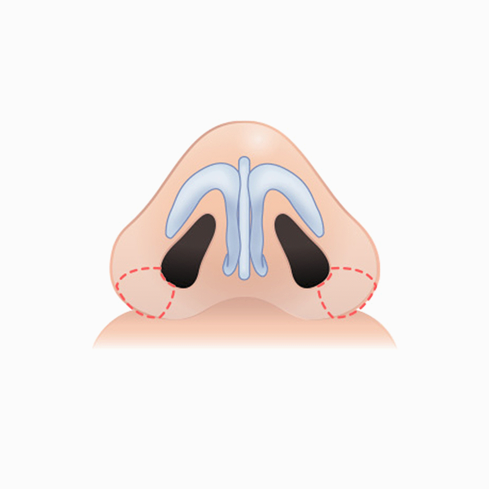 복코