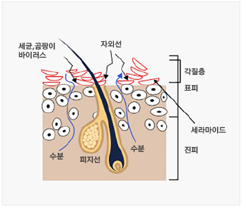 노화된 피부
