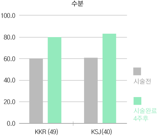 리쥬란 힐러