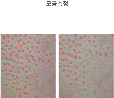 리쥬란 힐러