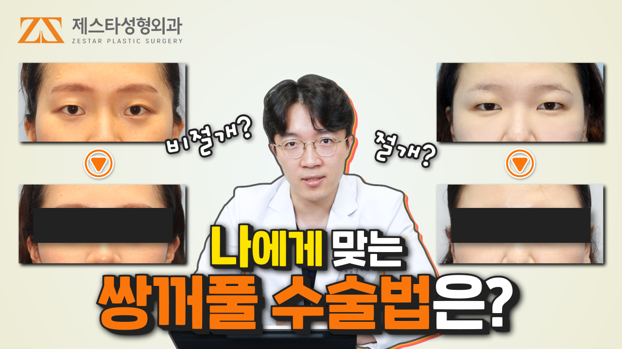 제스타유튜브